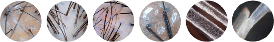 APM PRO 200 do analizy skóry głowy i włosów